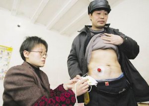 男子回腸盲腸被誤割 醫(yī)院稱：不是好大個事