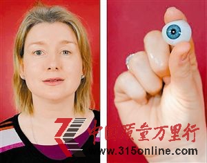 斯通左眼摘除后安裝了假體眼球。