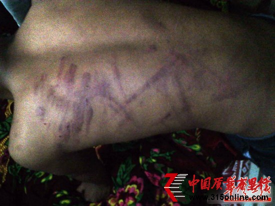 網(wǎng)曝云南省富源縣一名老師持續(xù)4小時體罰學(xué)生，期間打斷5根電線。（圖為被體罰學(xué)生）網(wǎng)絡(luò)截圖